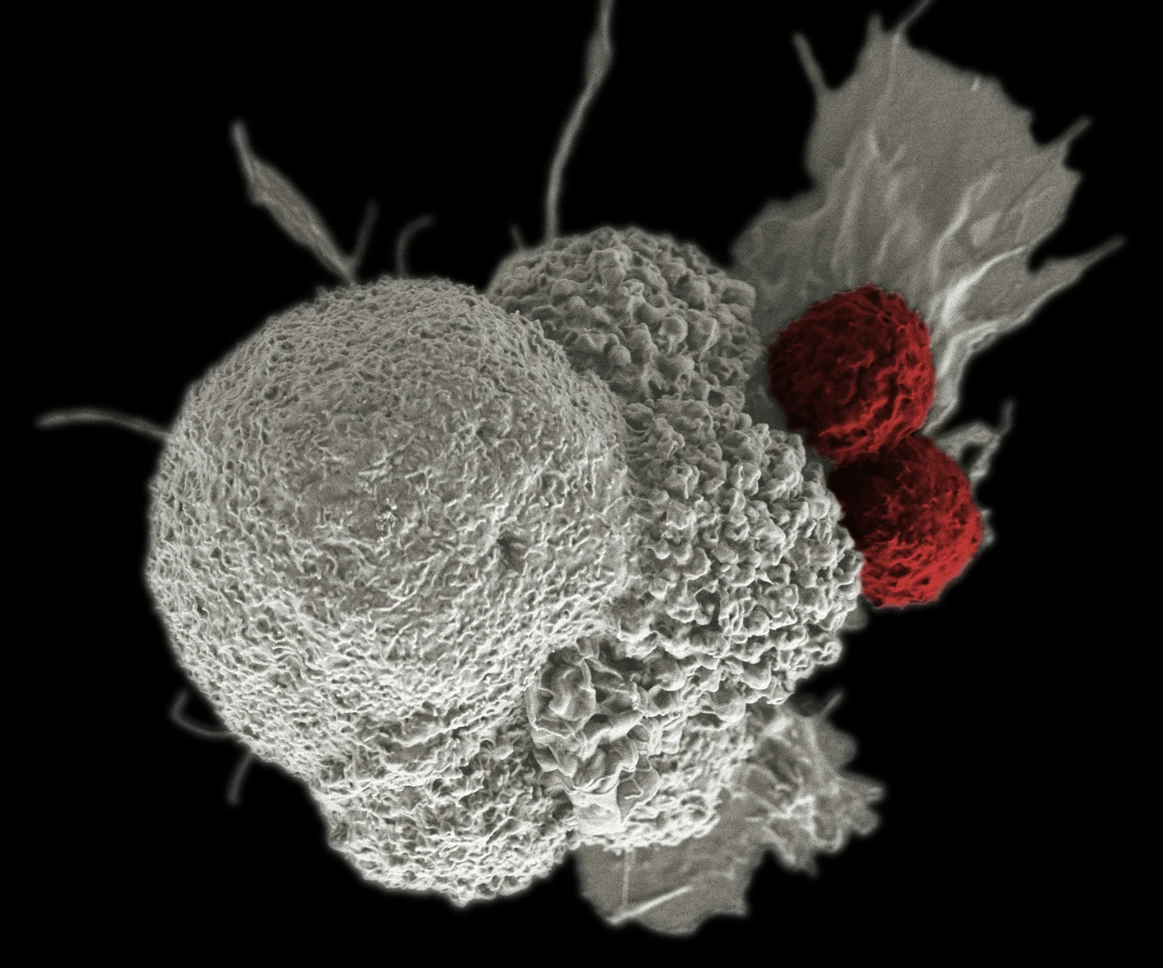 Sorpresa dalla ricerca: un farmaco antiparassitario si rivela efficace contro il melanoma più aggressivo Immagine selezionata