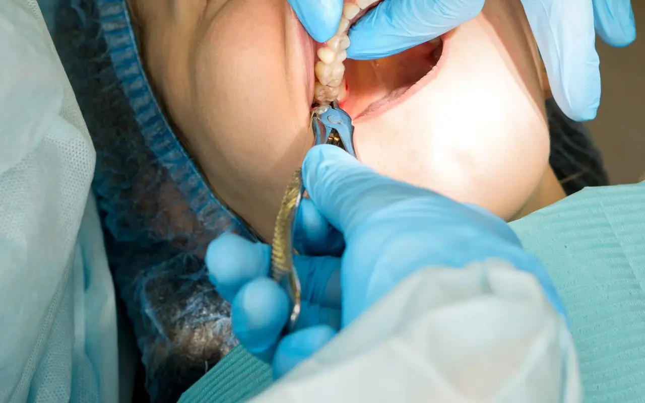 Come vengono stabiliti i prezzi nei dentisti pubblici: cosa c’è da sapere Immagine selezionata